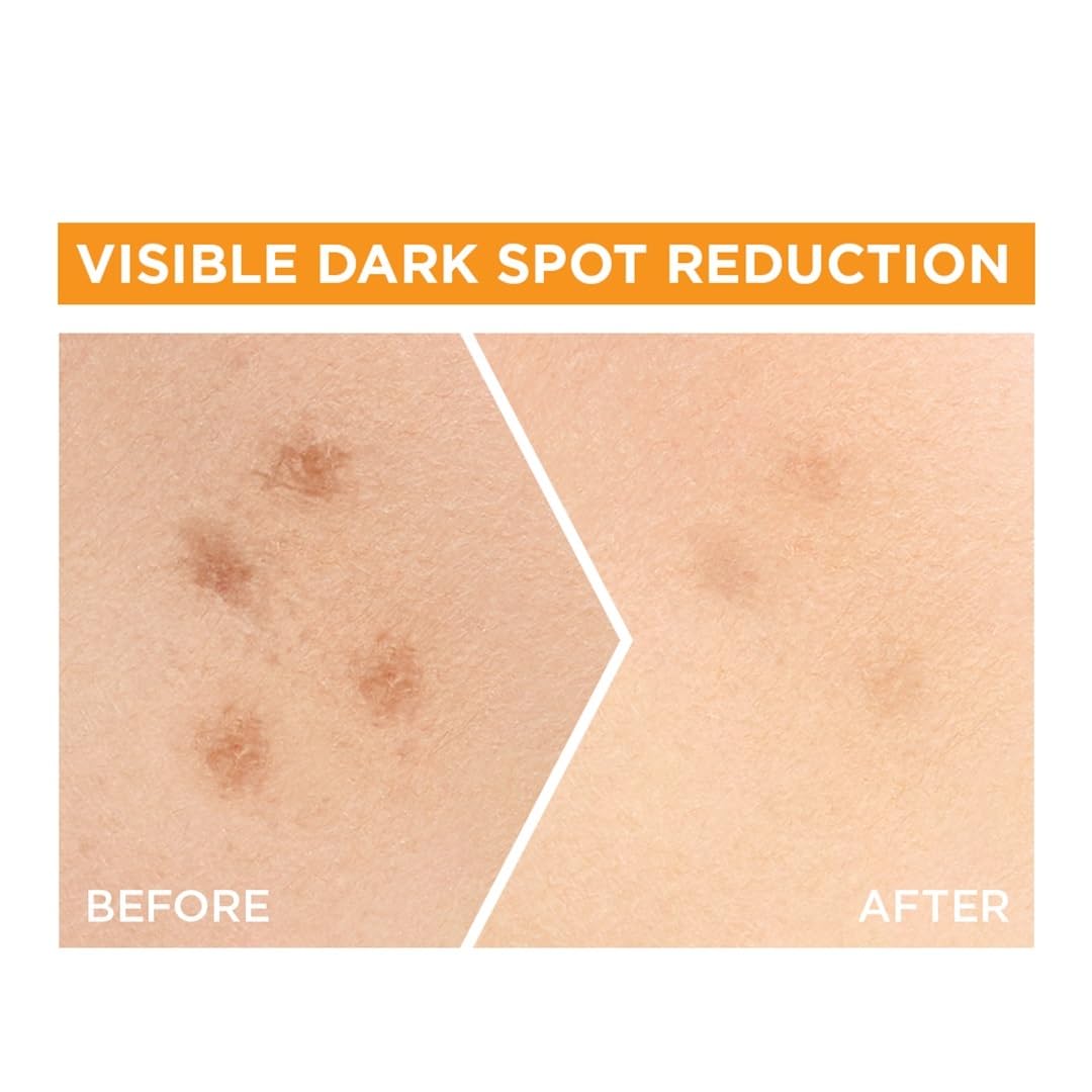 Garnier Skin Naturals, Face Serum, Brightening and Anti-Dark Spots, Bright Complete Vitamin C Booster, 50 ml