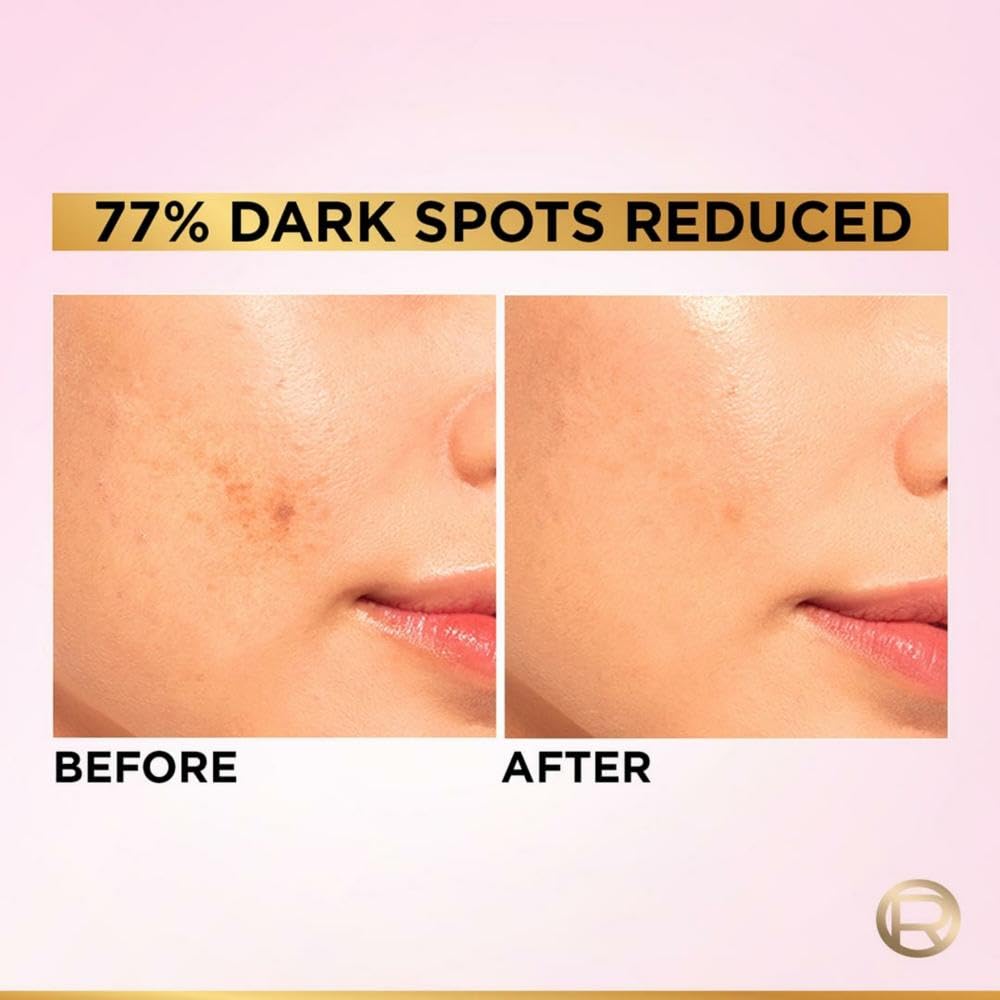 L'Oreal Paris Glycolic Bright 8% [Melasyl + Niacinamide] Face Serum for Brightening Dark Spots 15ml